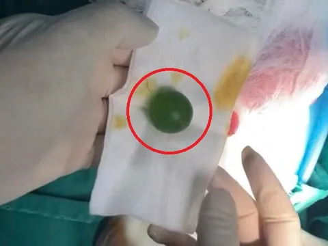 Bé 13 tháng liên tục nôn ói không rõ lý do, sự thật khiến bác sĩ lạnh sống lưng