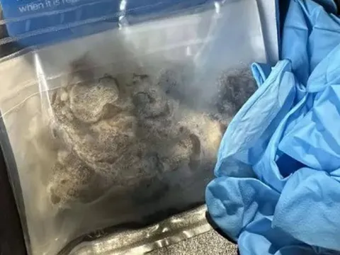 Nam 17 tuổi nguy kịch, phải cắt một phần phổi vì thói quen "gây nghiện" của giới trẻ