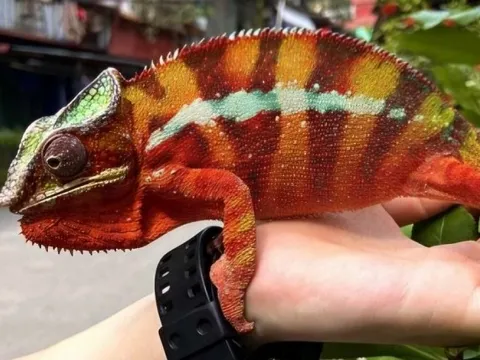 Cô gái 28 tuổi nhập viện sau khi bị "sinh vật lạ" trong nhà tấn công