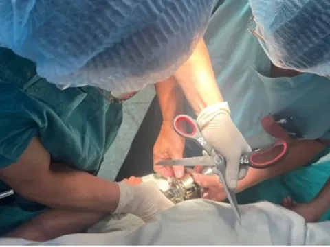 Bé trai 5 tuổi "ôm" ổ khóa nhập viện cấp cứu, bác sĩ phát cảnh báo khẩn