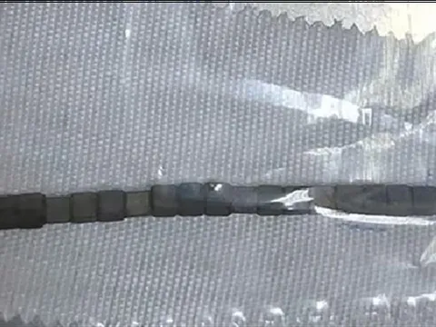 Bé trai hơn 2 tuổi "bụng cứng như đá", bác sĩ phát hiện bí mật "đáng sợ"