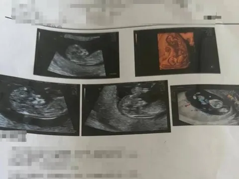 Đi khám thai, người phụ nữ sốc nặng sau khi thấy kết quả siêu âm