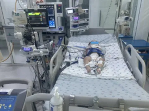 Bé gái hơn 1 tuổi nguy kịch vì phút lơ là của người lớn, bác sĩ cảnh báo thói quen "chết người"