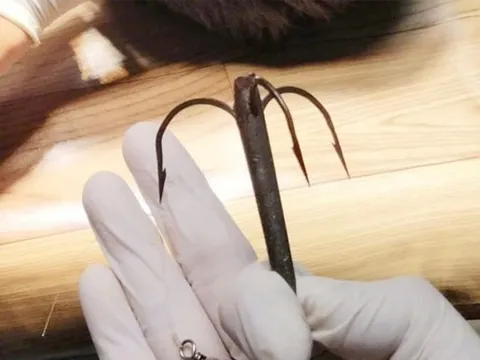 Thiếu niên gặp sự cố hi hữu khi đi câu cá, phải nhập viện xử lý gấp