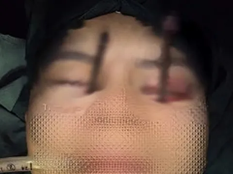 Chàng trai 25 tuổi đau mắt dữ dội, bác sĩ phát hiện bí mật "đáng sợ"