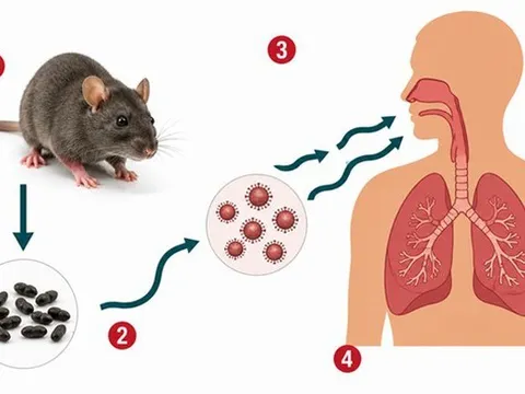 Bộ Y tế phát khuyến cáo khẩn về bệnh do virus Hanta gây ra