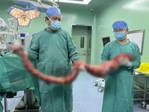 Người đàn ông 4 tháng không đi đại tiện, bụng phình to như "mang thai", bác sĩ lấy ra thứ "đáng sợ"