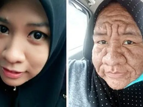 Cô gái 28 tuổi bỗng “già như cụ bà” U80: Bí ẩn phía sau gây bất ngờ
