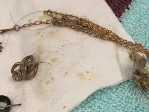Mổ bụng cứu chó hoang, bác sĩ “đứng hình” khi phát hiện dây chuyền vàng đắt đỏ