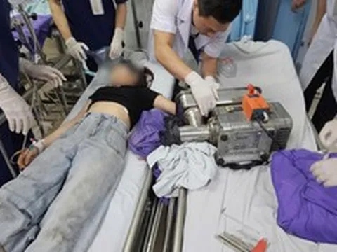 Một phút bất cẩn, cô gái 19 tuổi đối mặt biến cố lớn
