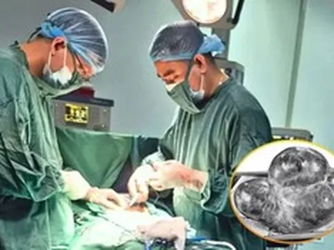 Bụng phình to bất thường, sự thật bác sĩ nói ra khiến người phụ nữ sốc nặng