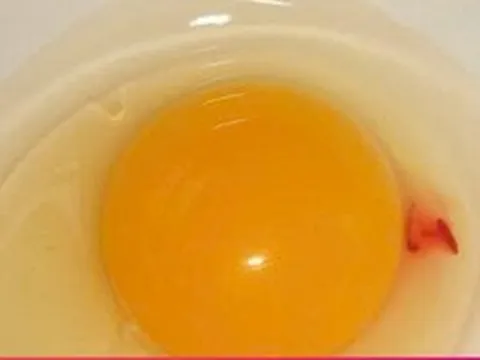 Vì sao lòng đỏ trứng lại có đốm máu? Câu trả lời khiến nhiều người bất ngờ