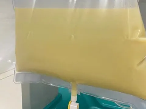 Nam thanh niên "máu trắng đục như sữa" vì ăn thứ quen thuộc nhiều người mê