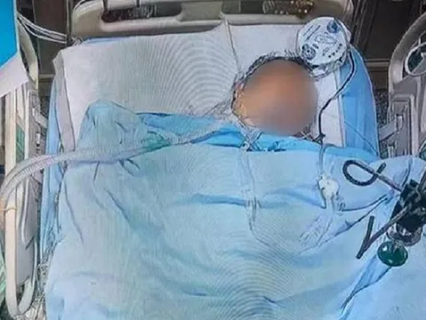 Người đàn ông 30 tuổi tử vong sau 10 năm ăn sáng theo kiểu "vạn người mê"