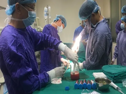 Phương pháp mới điều trị ‘đột quỵ não’ từ tế bào gốc tự thân