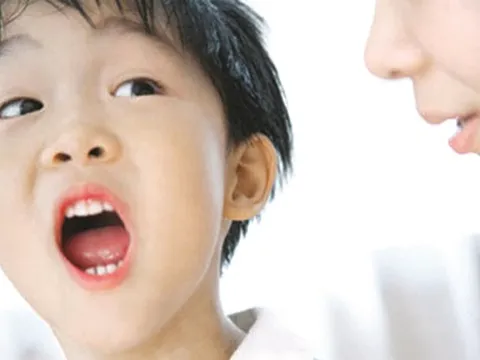 Trẻ nói ngọng... không thể xem thường